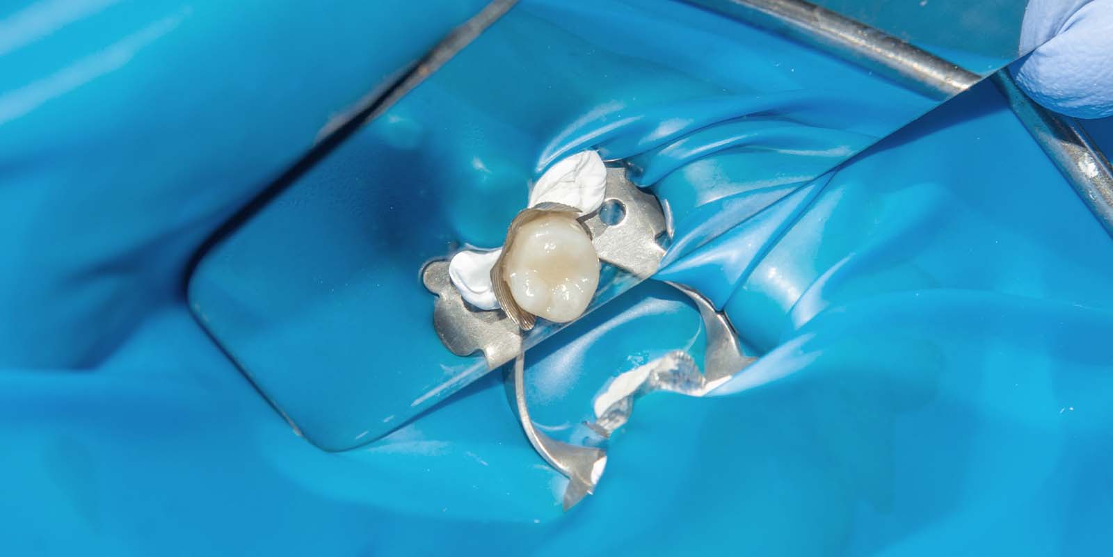 根管治療に使用している機器